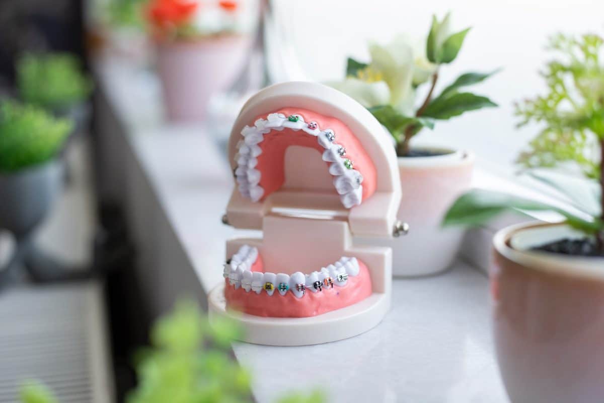 Phases des traitements orthodontiques pour une santé dentaire optimale
